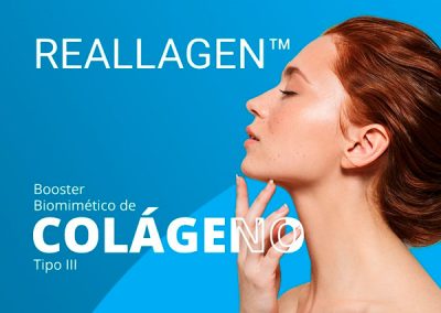 Reallagen